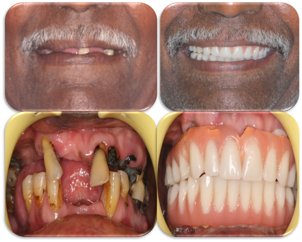 Before/ after treatment photos