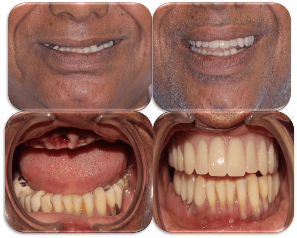 Before/ after treatment photos