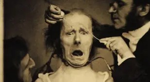 Duchenne De Boulogne Terror