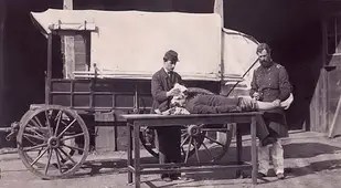 Civil War Amputation