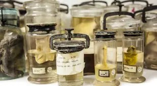 Cholera Wet Specimens