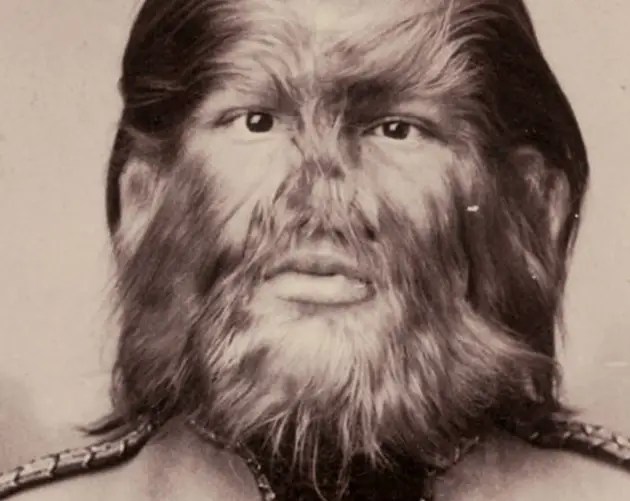 Fedor Jeftichew Dog Faced Boy