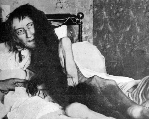 Creepy Old Photo Of Blanche Monnier