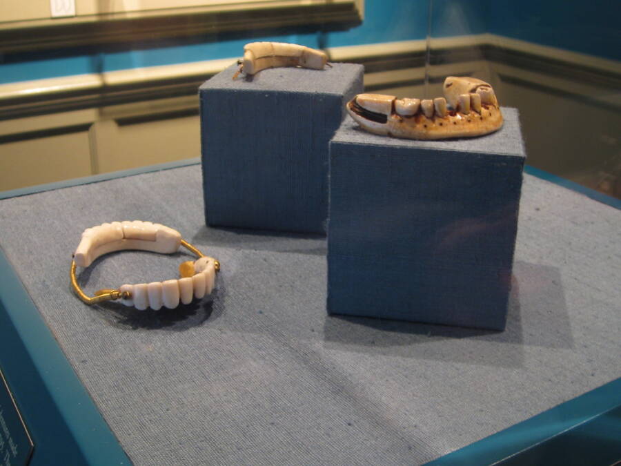 George Washington Dentures