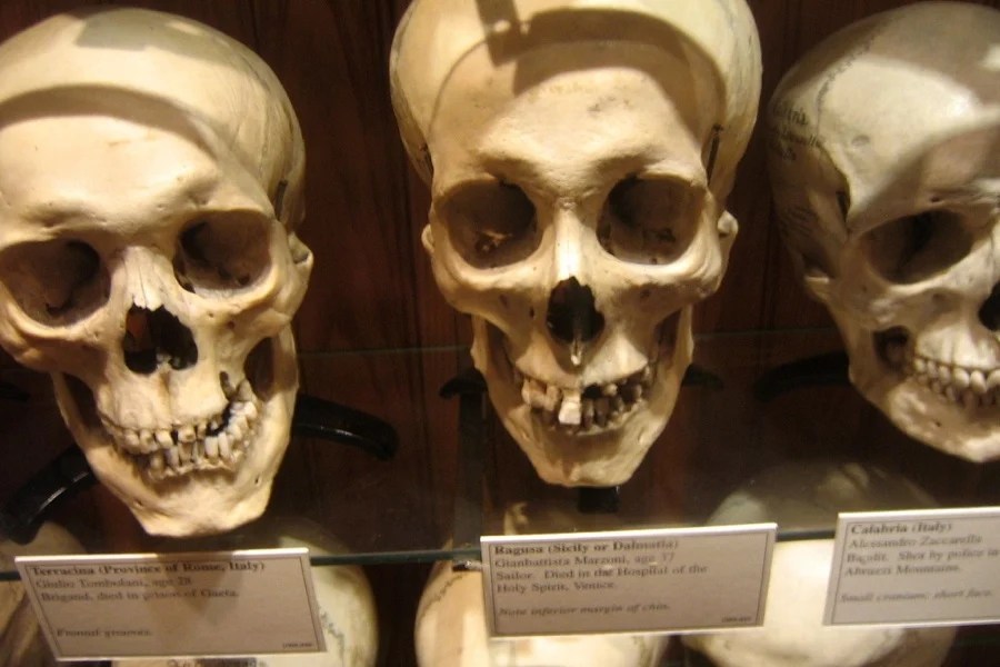 Human Skulls