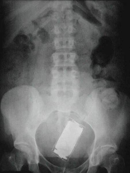Funny Xray Pictures