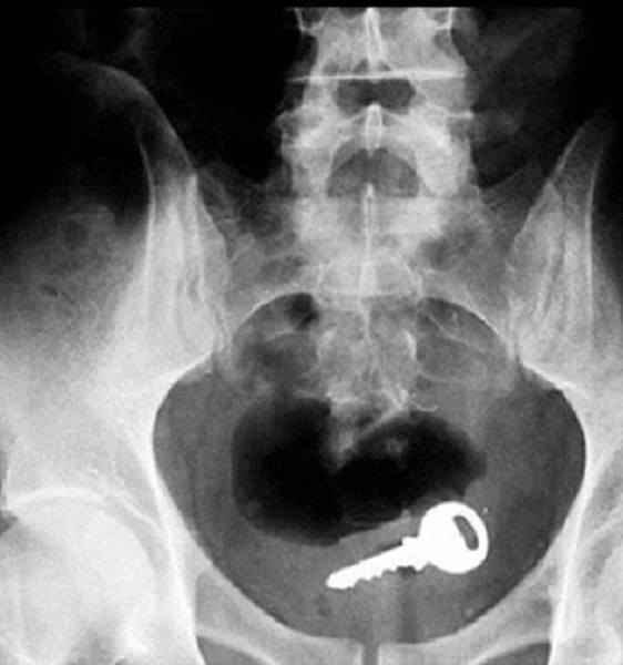 Funny Xrays