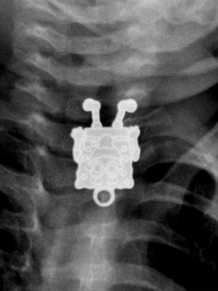 Funny Xray Spongebob