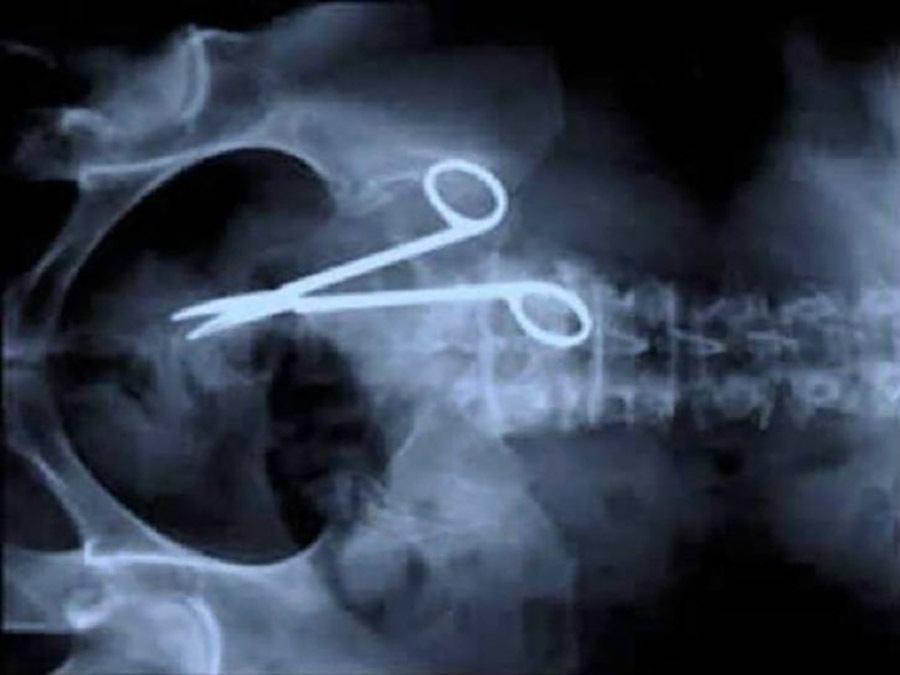 Surgical Scissors