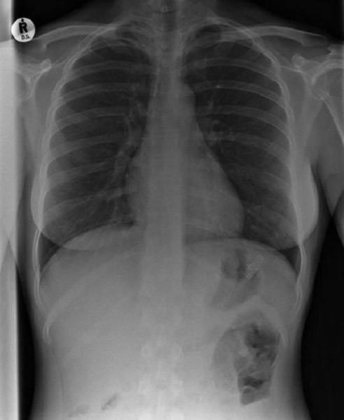 Funny Xray Toothbrush