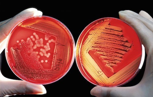 Superbugs Dish