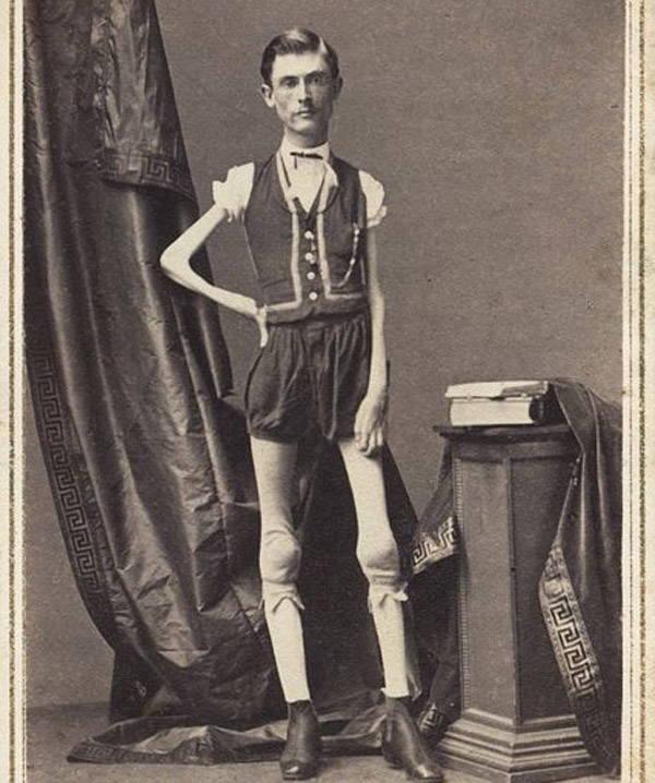 25 Tragic Photos Of Vintage "Freak Show" Performers From "Elastic Man
