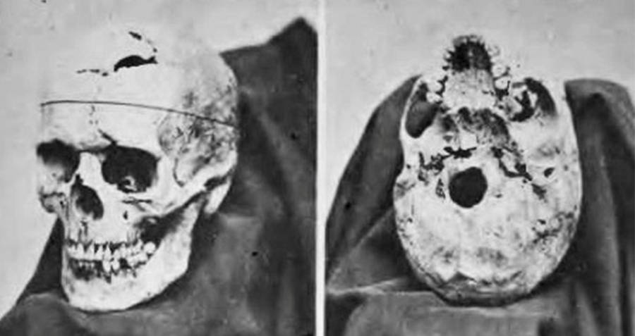 Phineas Gage&rsquo;s Skull