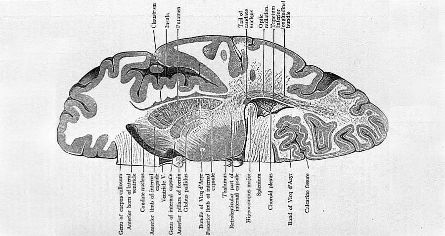 Split Brain Diagram