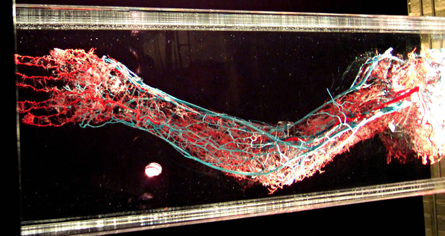 Circulatory System Arm