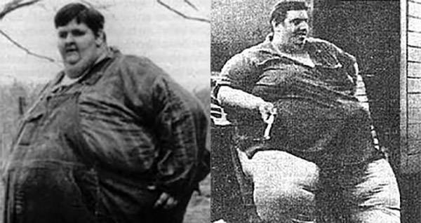 Meet Jon Brower Minnoch, The Heaviest Person In The World(03)