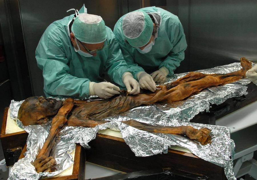 Ötzi The Iceman
