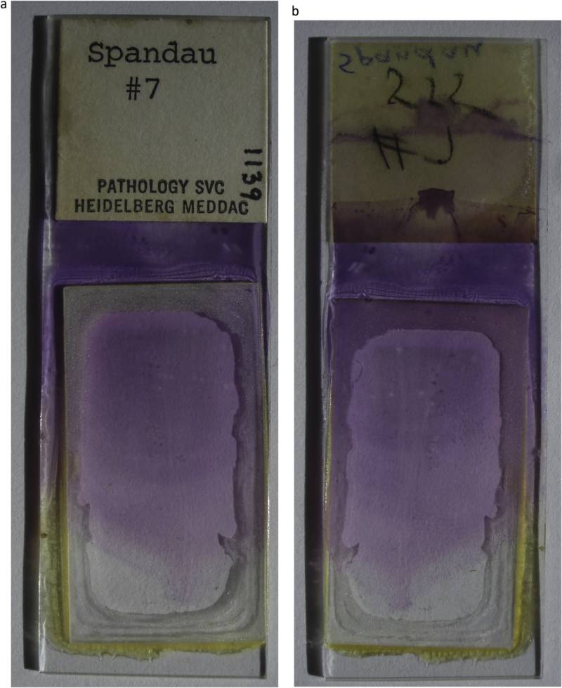 Blood Sample Slide