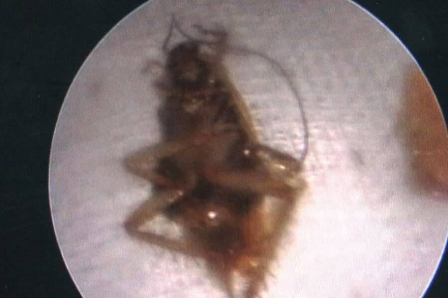 Mother Cockroach Under A Microscope