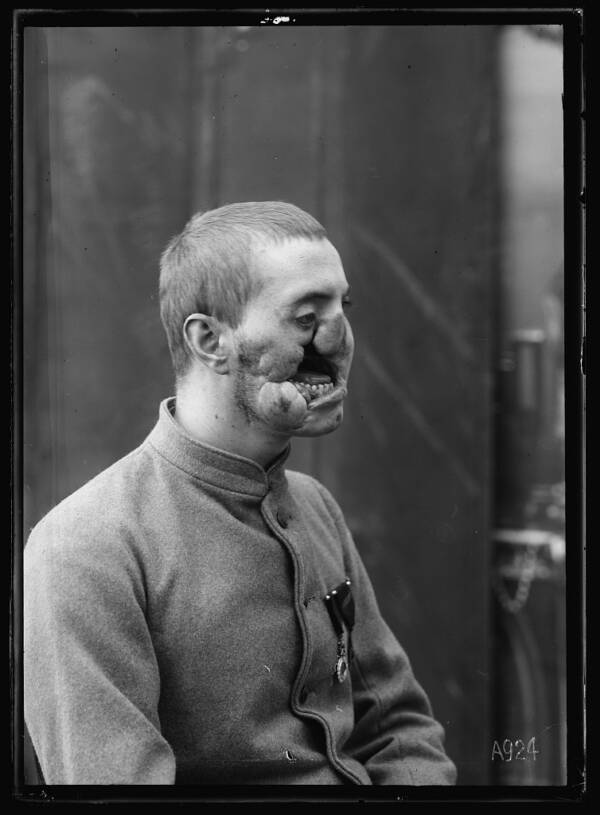 How Anna Coleman Ladd Restored The Faces Of World War I