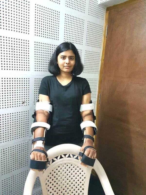 Shreya Siddanagowda And Her New Hands