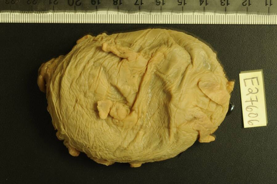 Scotoplanes Species On Land