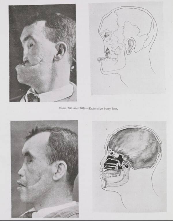 Harold Gillies&rsquo;s Book