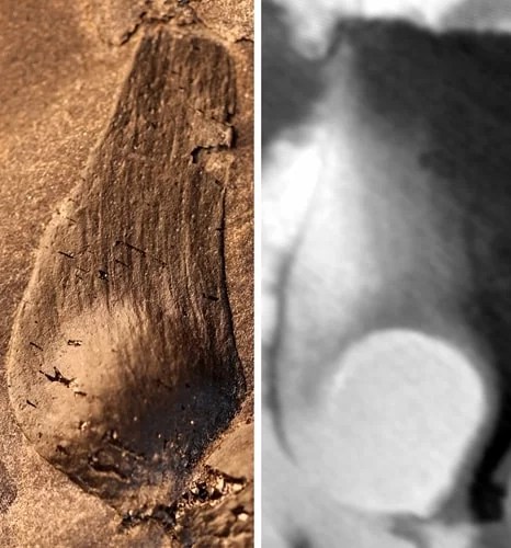 Fruits Of Qingganninginfructus Formosa