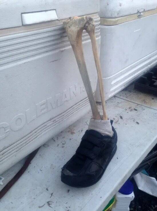 Pacific Northwest Severed Foot Case