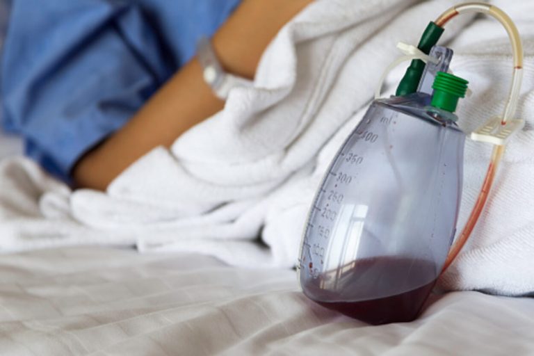 JP Drain vs. Blake Drain Unveiling the Variances (Detailed Explanation