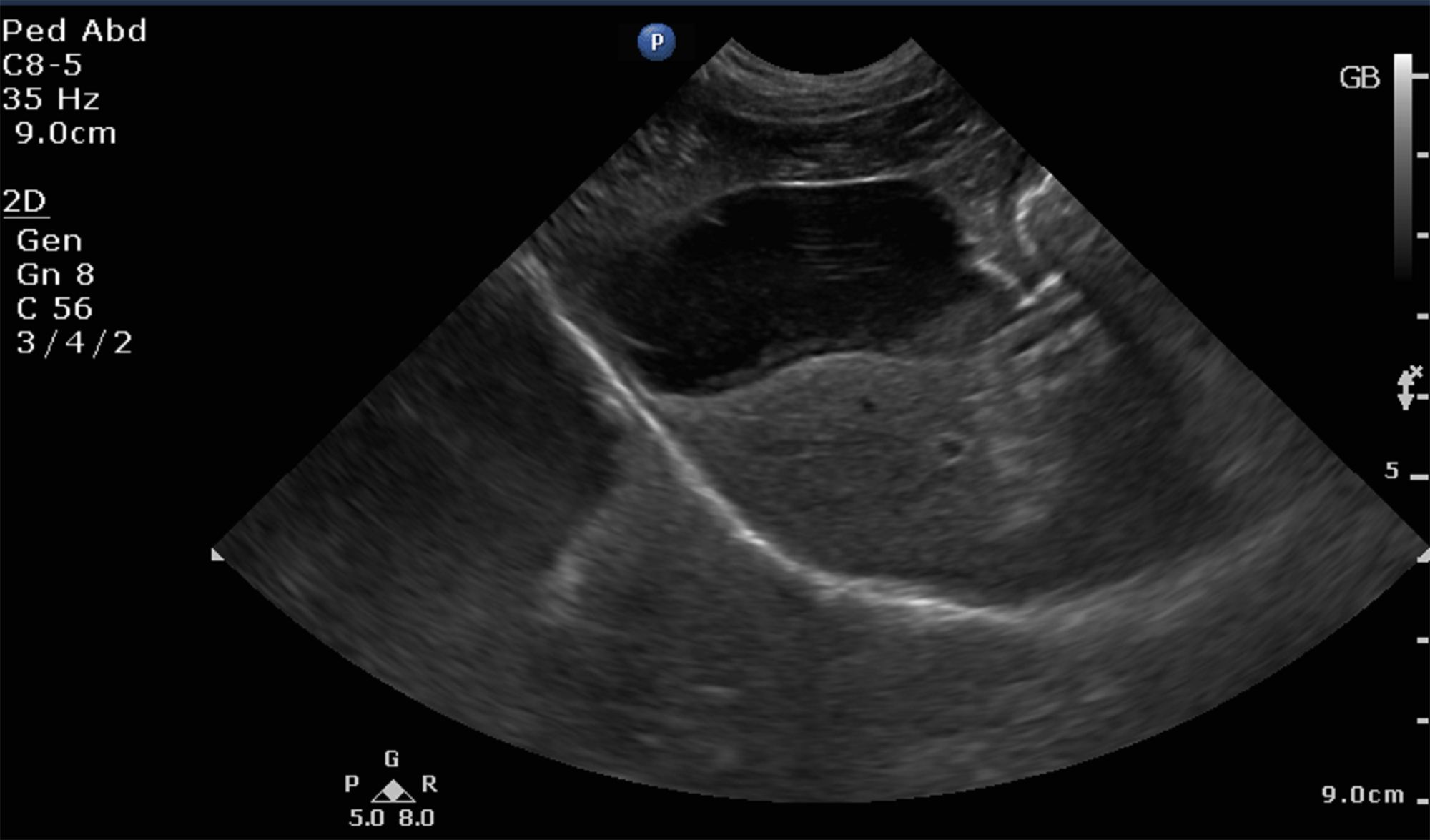 Why an Ultrasound? Ally Veterinary Imaging
