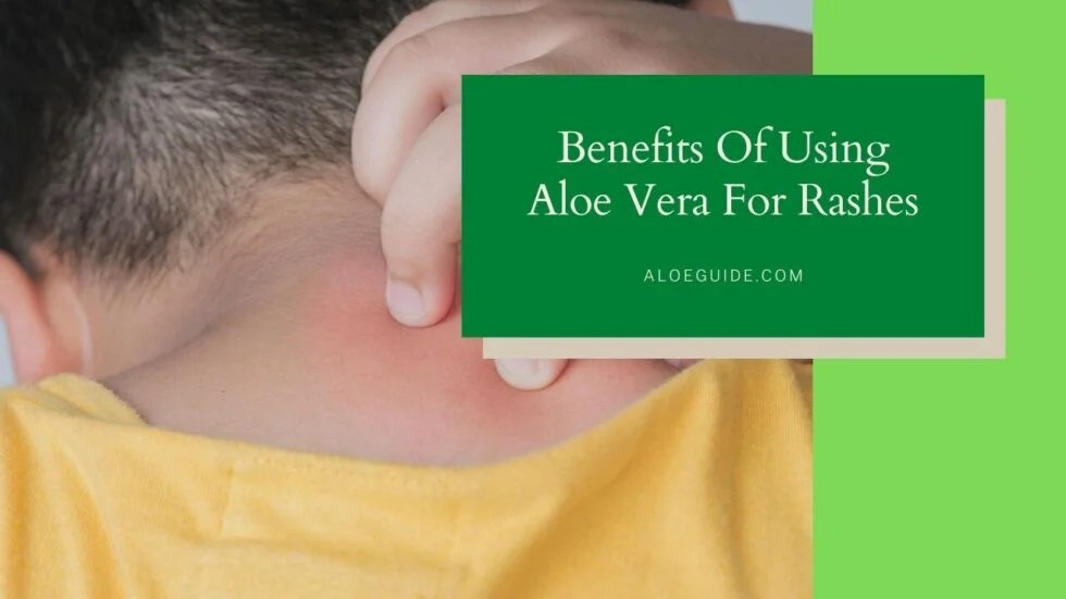 Aloe Vera For Rashes [Research, Efficacy and more] Aloe Guide