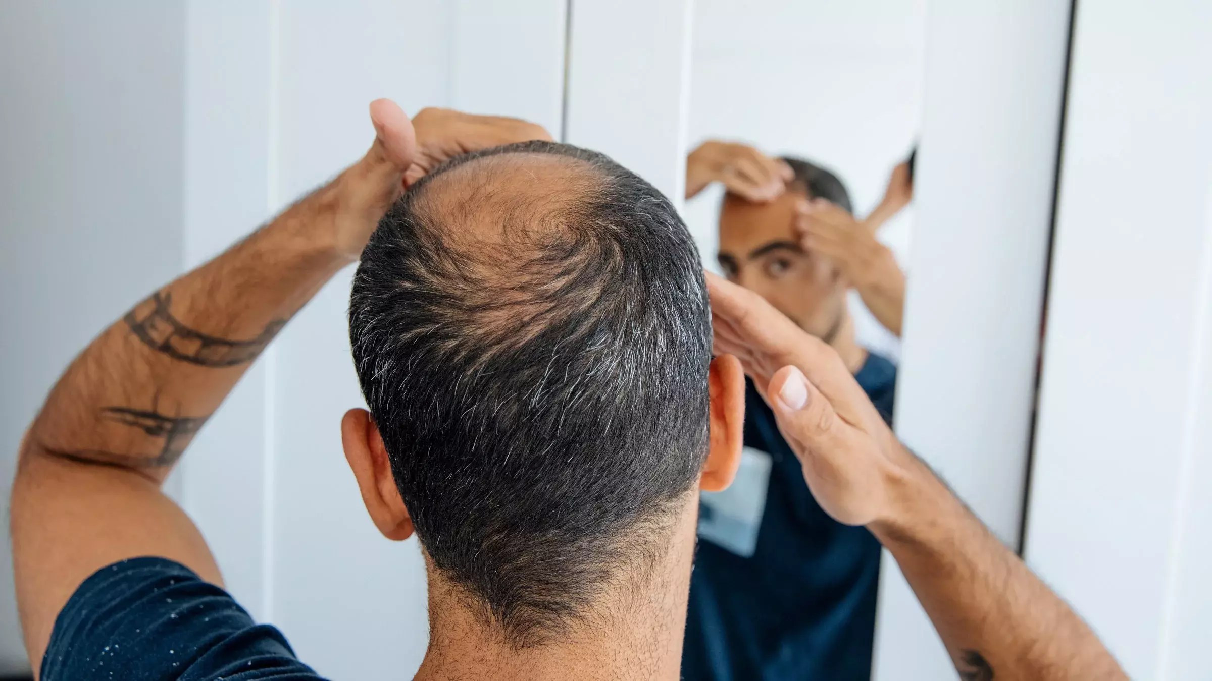 Best Men’s Hair Loss Treatments Clinic in Colorado