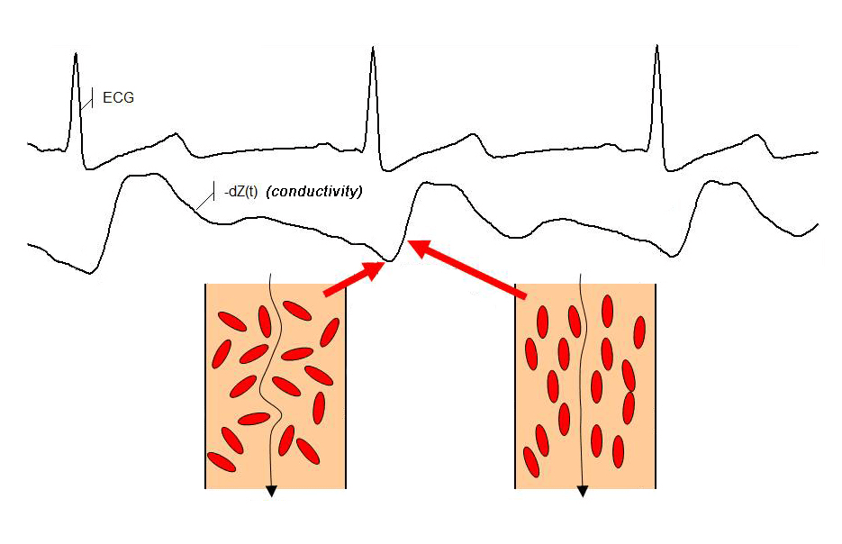 Electrical Cardiometry Technology Alpha MedTech Limited