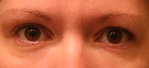 Hemorrhoid Creams For Wrinkles: Under Eyes And Side Effects Does Preparation H Reduce Puffiness Around The Eyes? | Alpha Mom