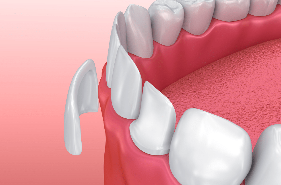 Cosmetic Dentistry Alpine Dentistry Cosmetic Dentist in Alpine, Utah