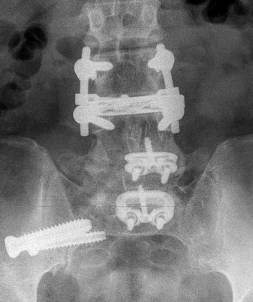 Spine Treatments Alpine Orthopaedic & Spine Spokane, WA