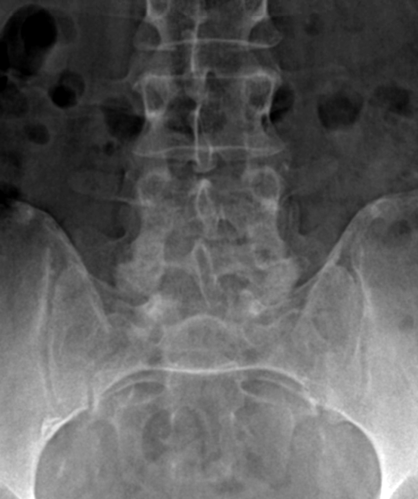 Spine Treatments Alpine Orthopaedic & Spine Spokane, WA