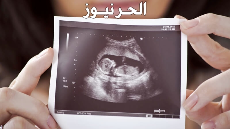 الافرازات بعد التبويض