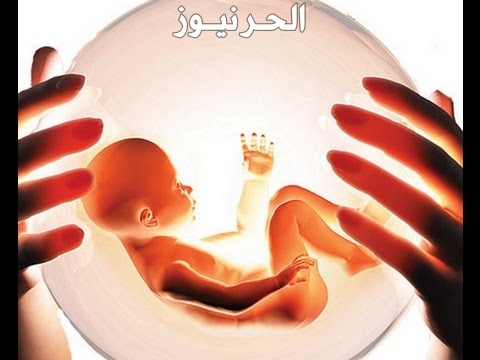 الاجهاض في الشهر الثاني