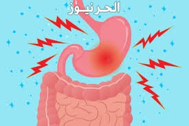 جرثومة المعدة