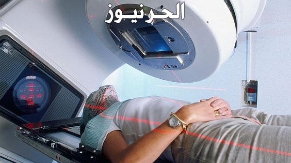 العلاج الاشعاعي