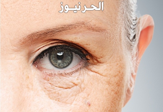كيفية علاج العين