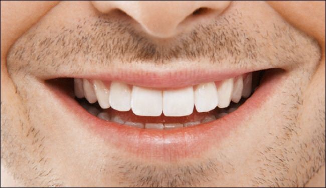 خلطات تبييض الأسنان في المنزل