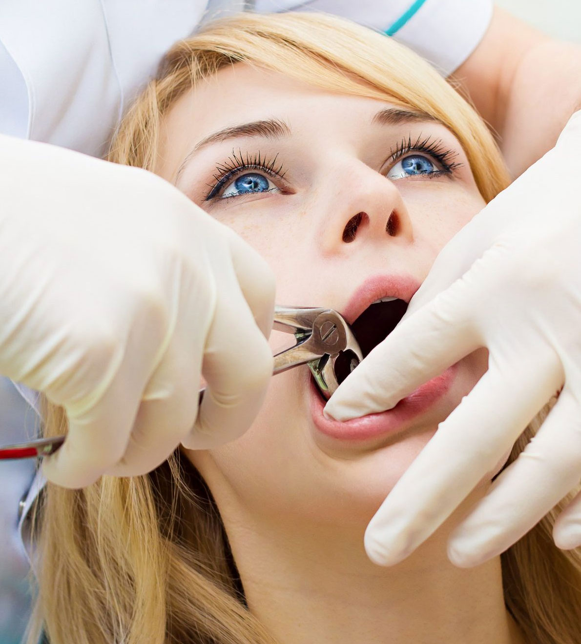 Surgical Extractions Al Shamil Medical Centre