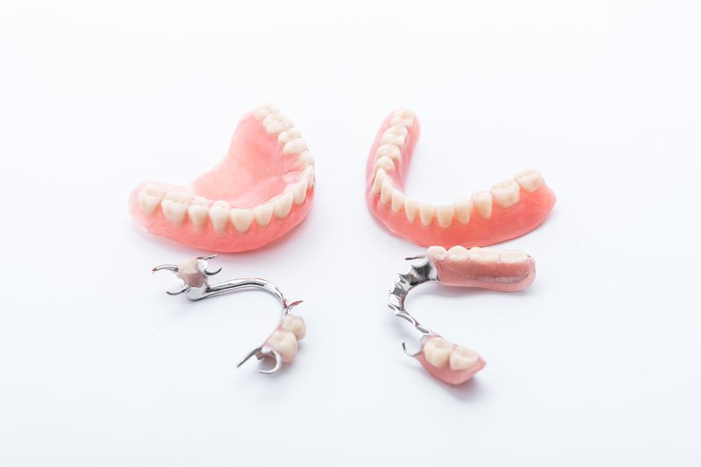 Dentures and The Various Types Alux Dental