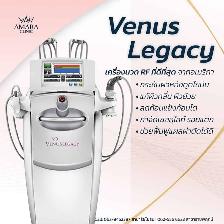 Venus Legacy นวด RF หลังดูดไขมัน กระชับผิว ลดผิวคลื่น ผิวย้วย กำจัดเซล