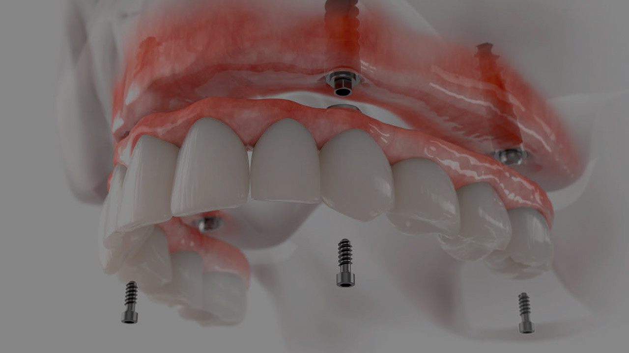 Amazing Smile dental design Lab Dental design lab, dental
