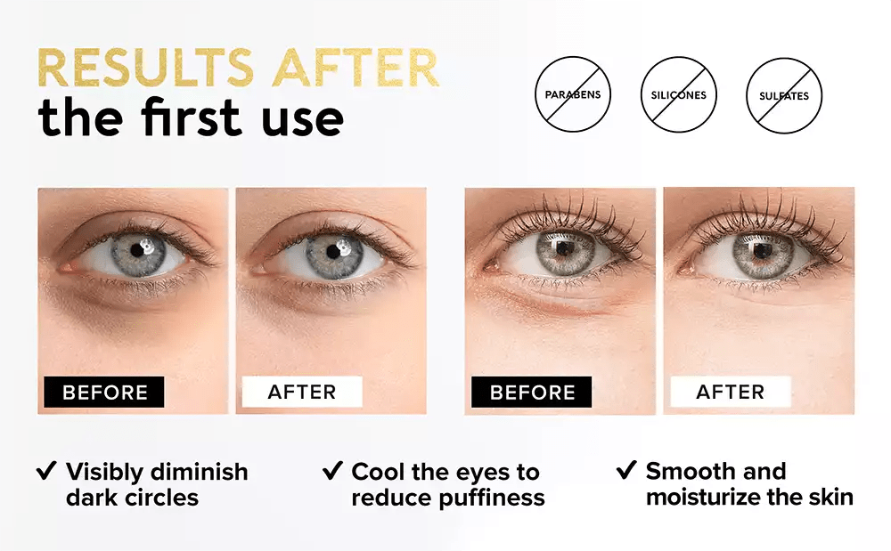 Maree Gold Eye Patches