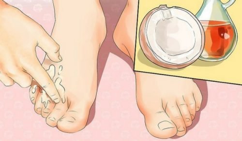 4 façons de se débarrasser des bosses sur les pieds